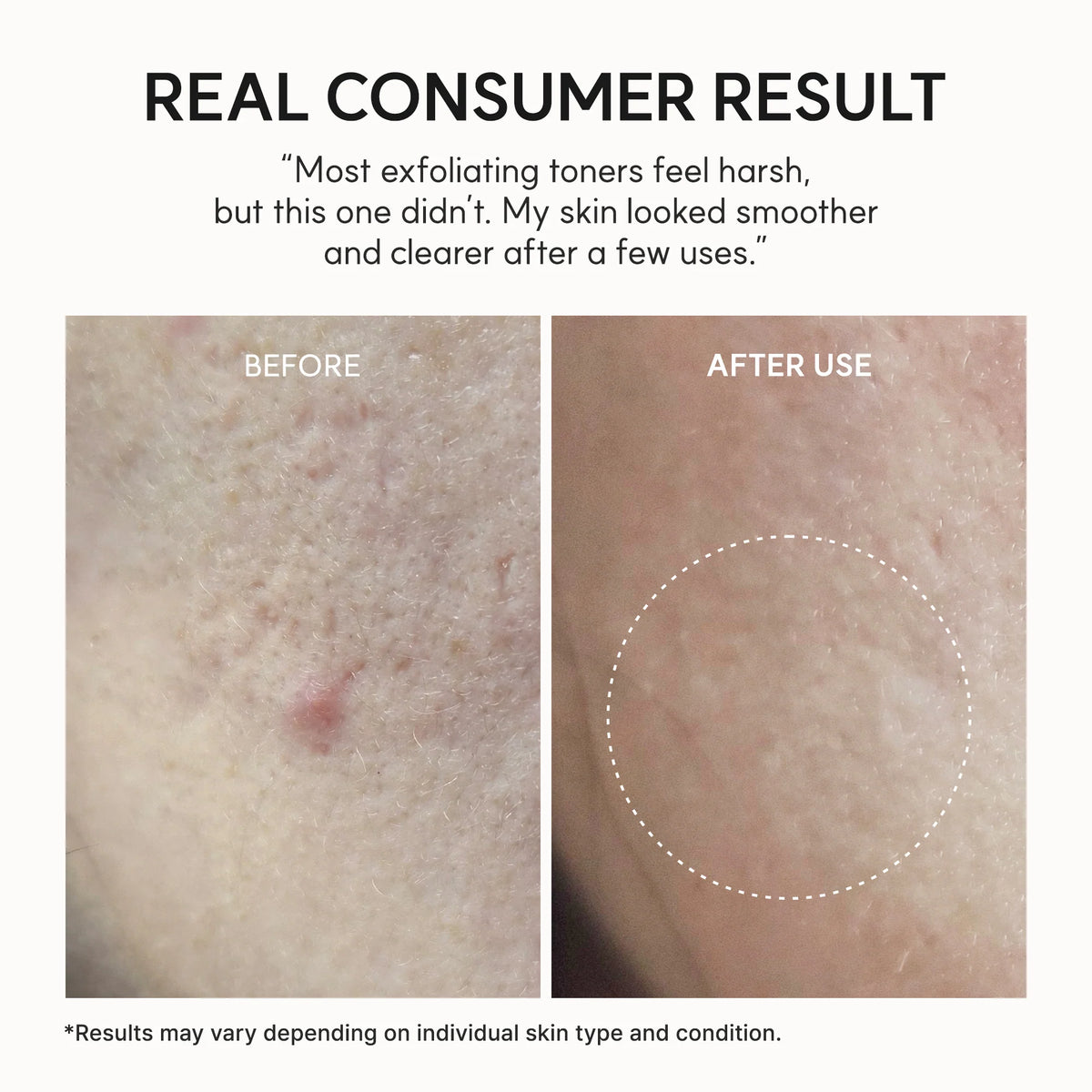 Arencia-Eraser Shot Glycolic Acid Exfoliator