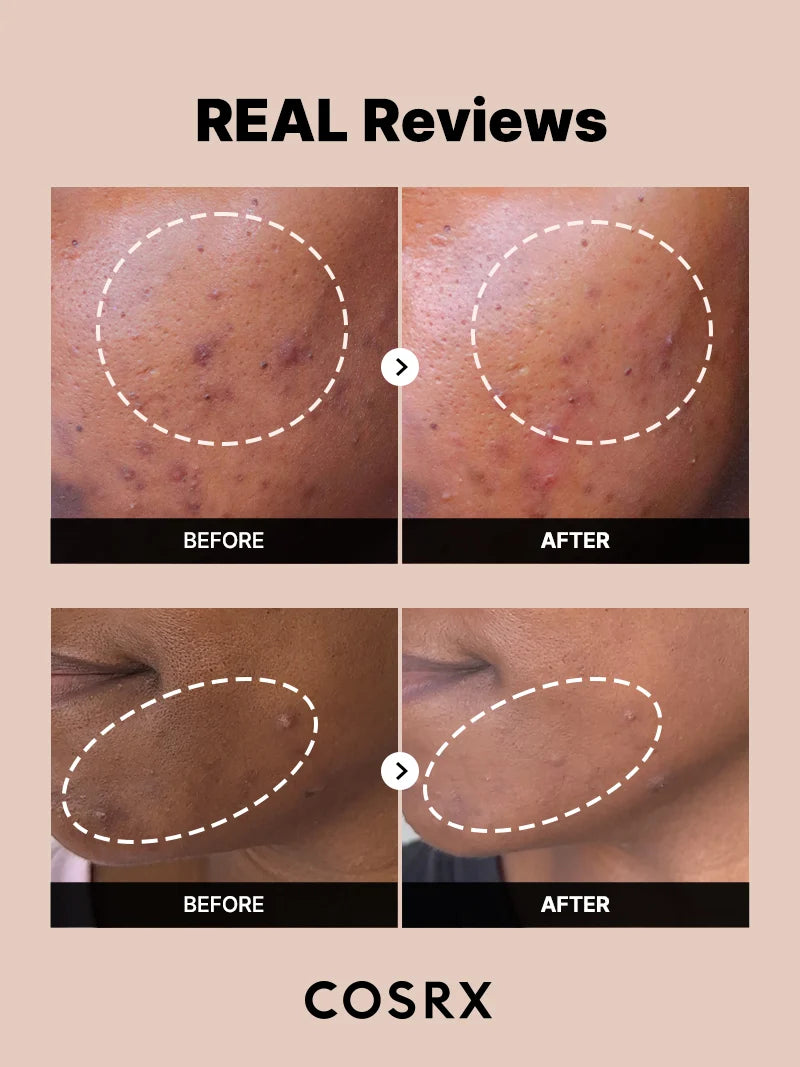 Cosrx-The Alpha-Arbutin 2 Discoloration Care Serum