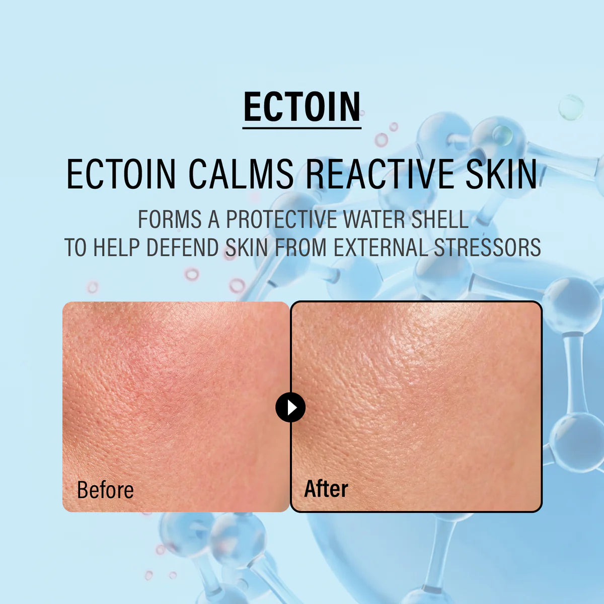 epii Double up cream, Ectoin & Panthenol
