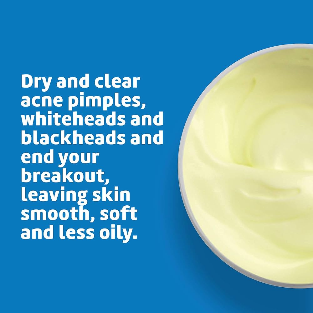De La Cruz - Acne Treatment with 10% Sulfur