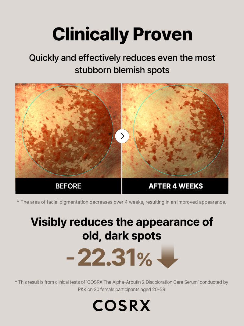 Cosrx-The Alpha-Arbutin 2 Discoloration Care Serum