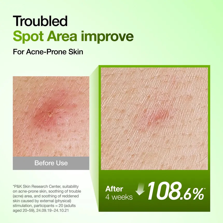 Anua - Kpop Demon Hunters Azelaic Acid 10 Hyaluron Redness Soothing Serum