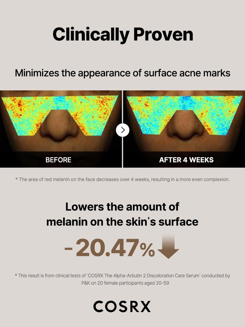 Cosrx-The Alpha-Arbutin 2 Discoloration Care Serum