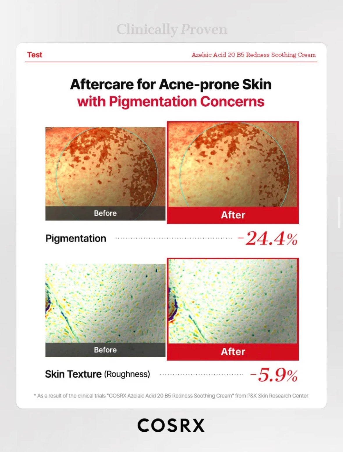 COSRX Azelaic Acid 20 B5 Redness Soothing Cream