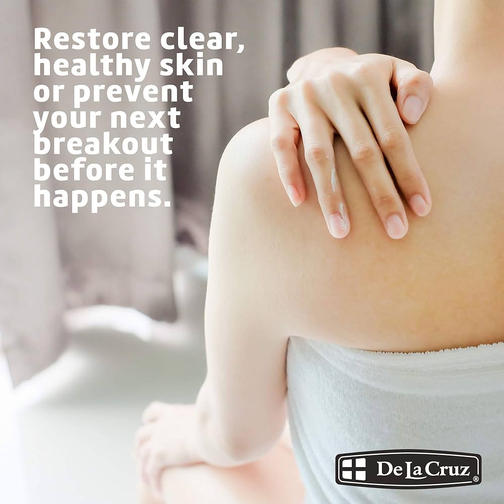 De La Cruz - Acne Treatment with 10% Sulfur