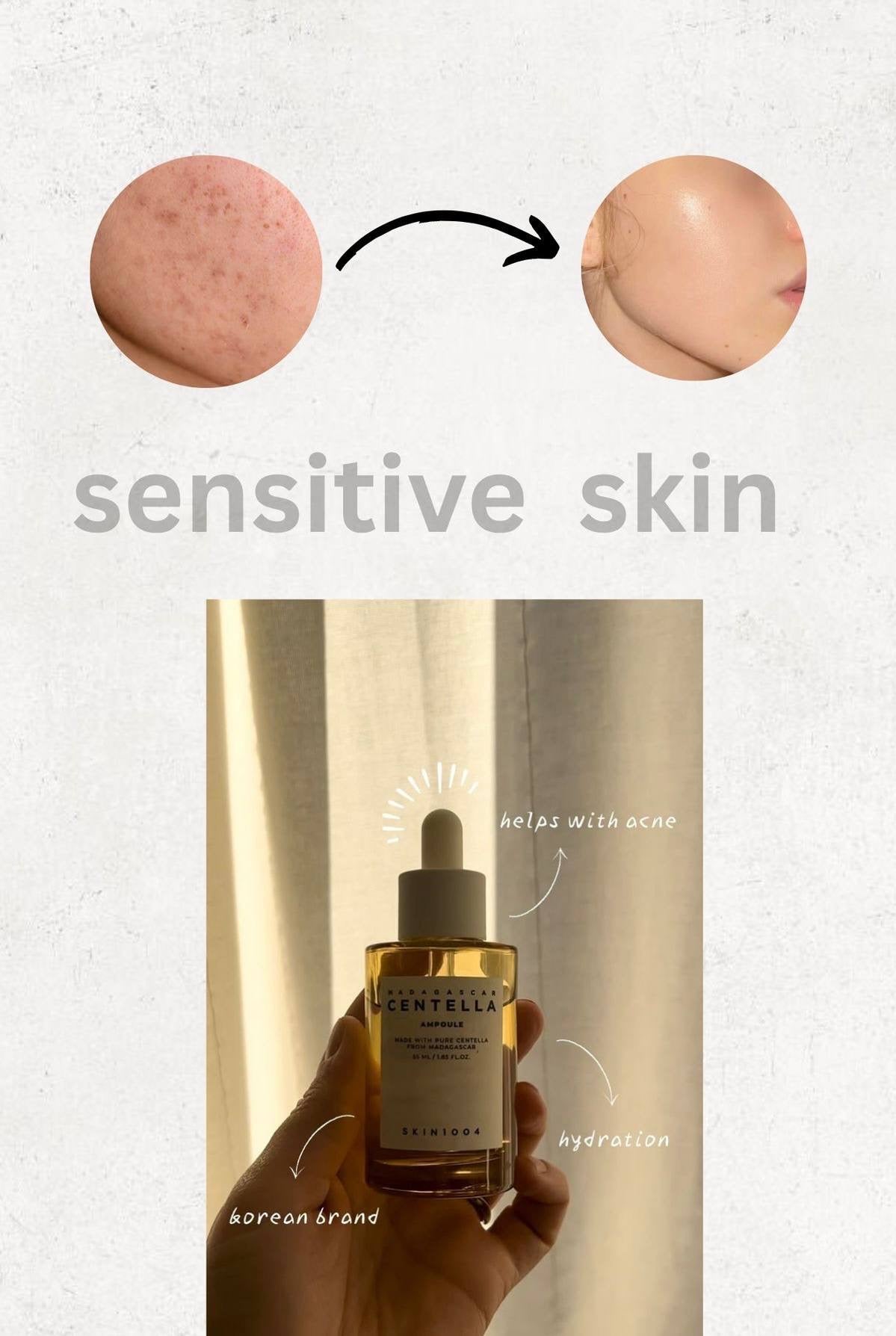 Madagascar Centella Ampoule