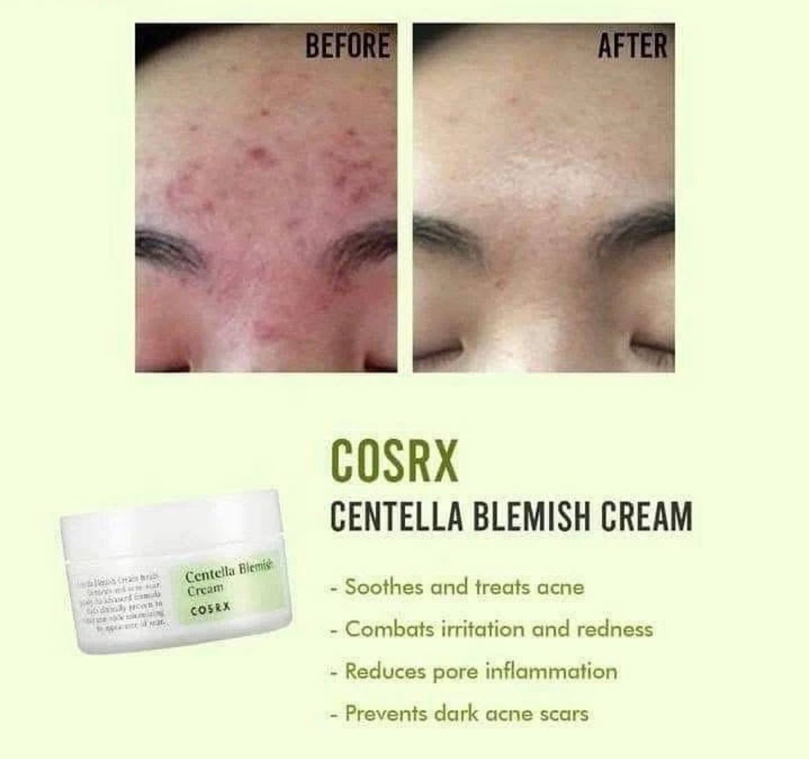 COSRX Centella Blemish Cream