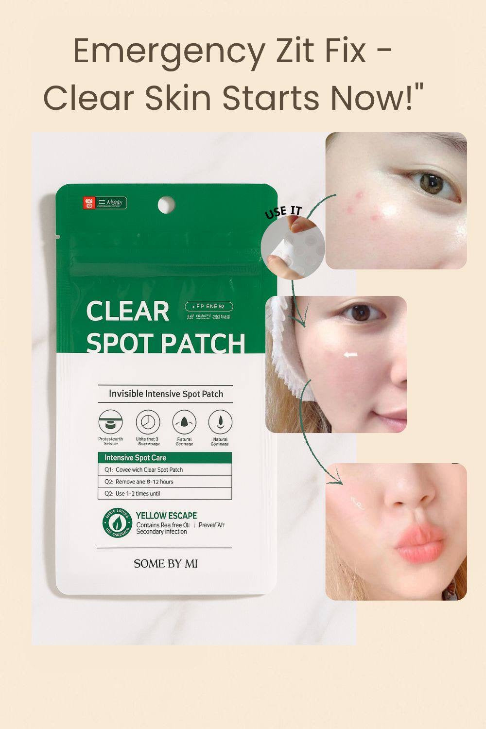 Some By Mi Clear Spot Patch